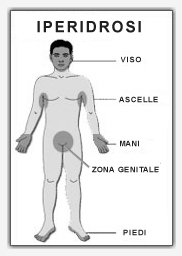 iperidrosi-zone