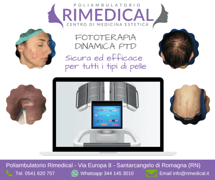 hevalight – fototerapia dinamica santarcangelo rimini hevalight - fototerapia dinamica santarcangelo rimini