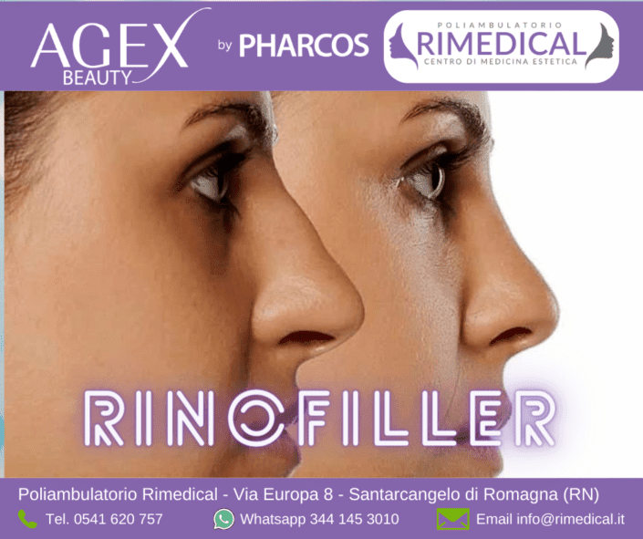 rinofiller rimedical rinofiller rimedical