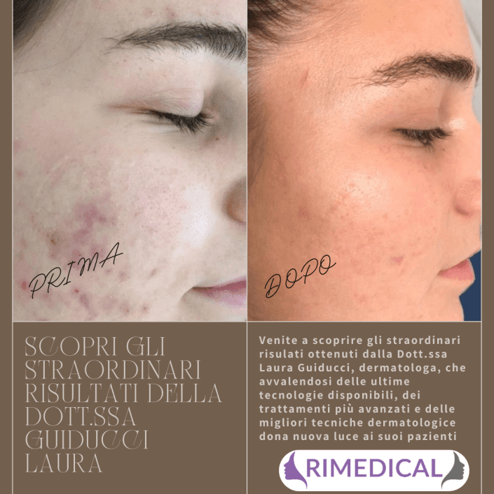 Prima dopo Guiducci