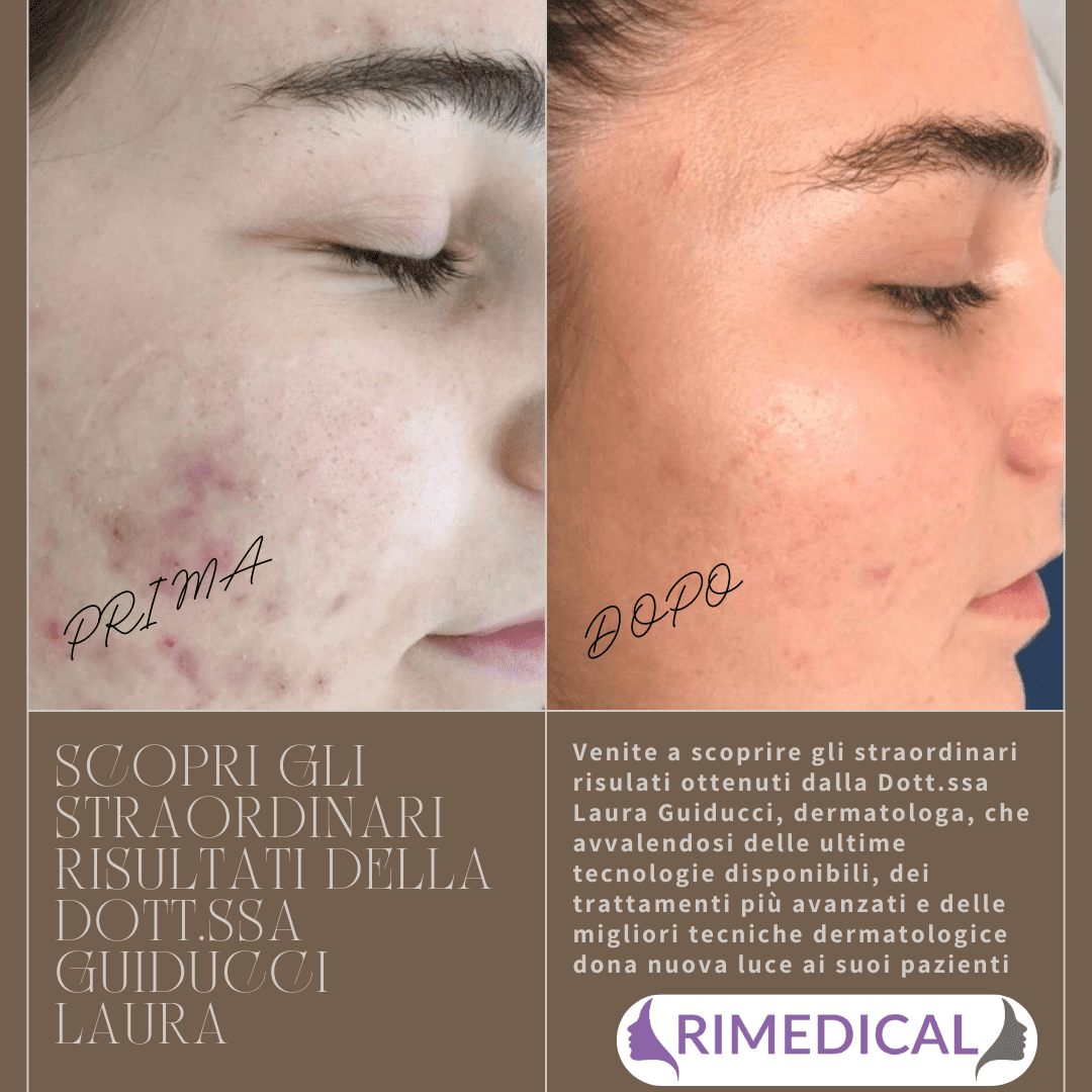 Prima dopo Guiducci