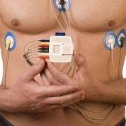 holter cardiaco