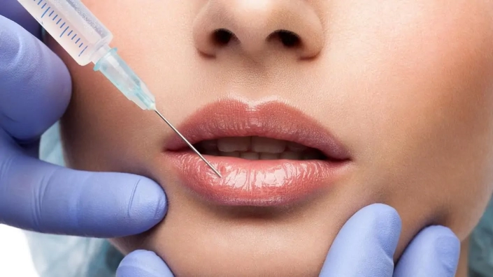 filler-labbra