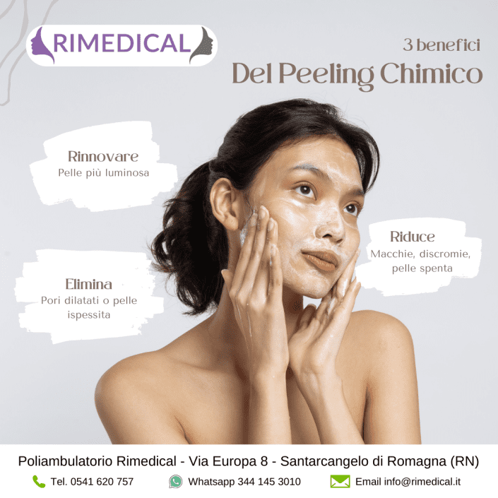 peeling-chimico