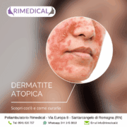 Dermatite Atopica: cos’è, perché viene e quando rivolgersi al dermatologo