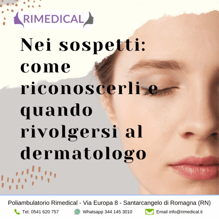 nei-sospetti