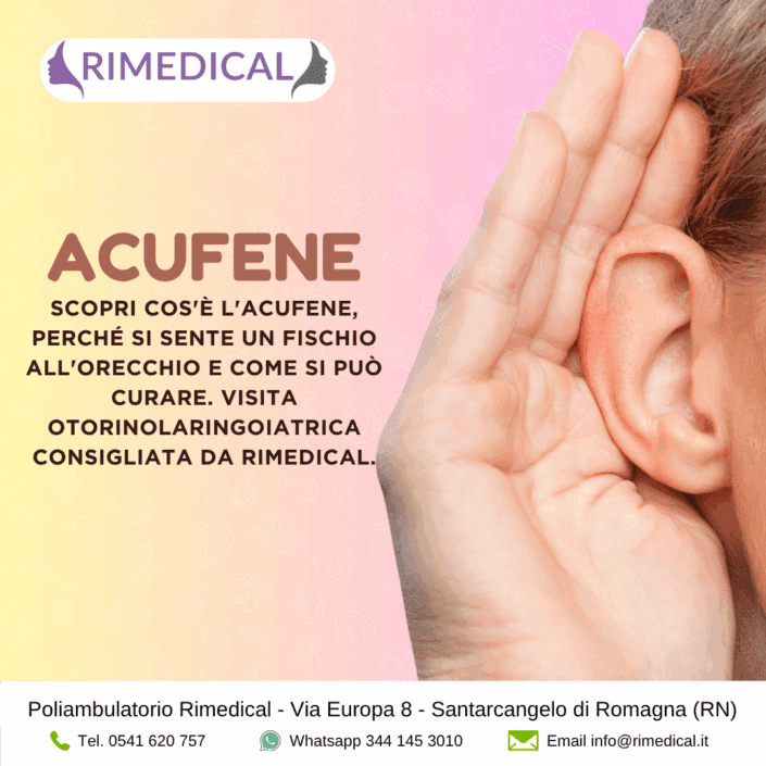 acufene