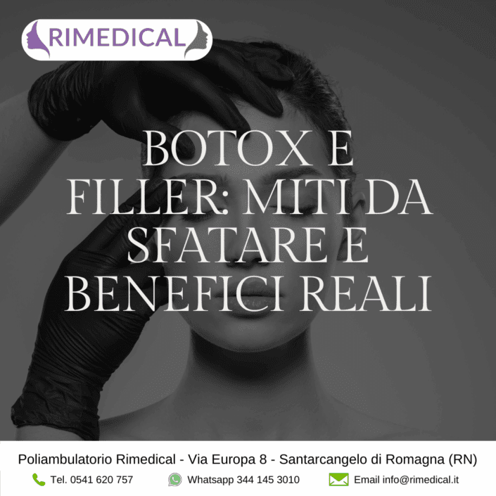 botox-filler-miti-sfatare