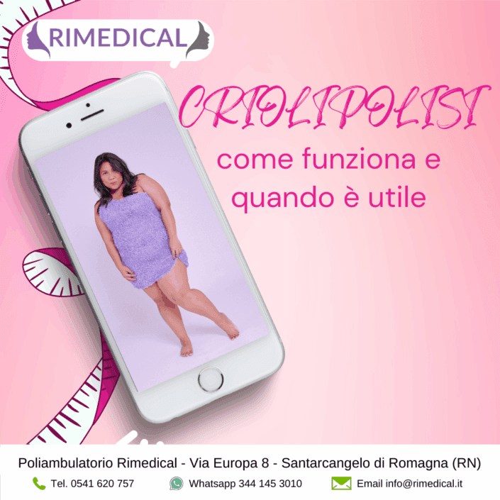 criolipolisi-cosè