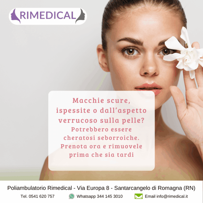 cheratosi-seborroica-promo