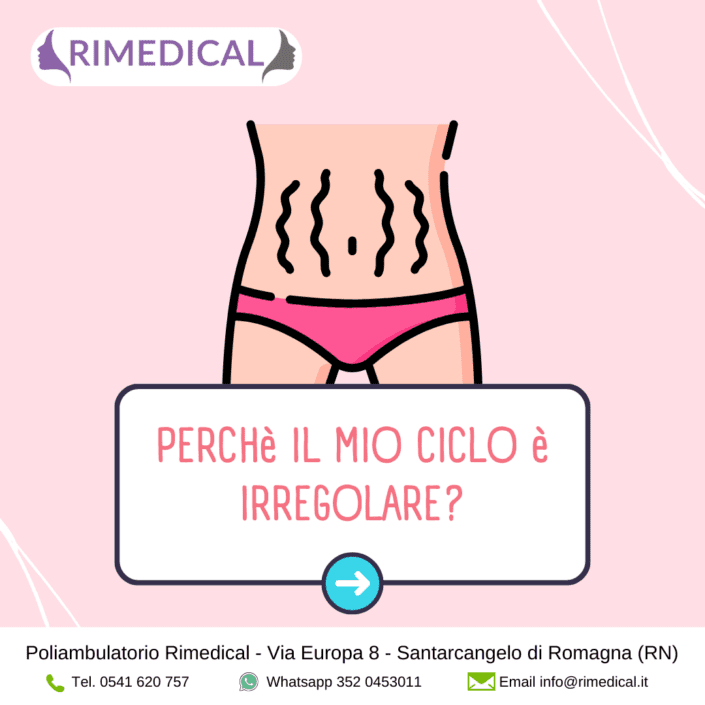 CICLO-IRREGOLARE