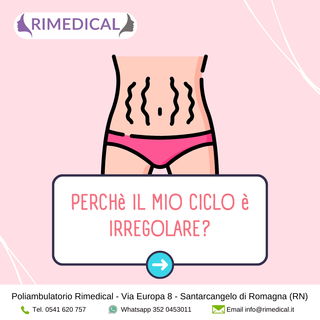 CICLO-IRREGOLARE