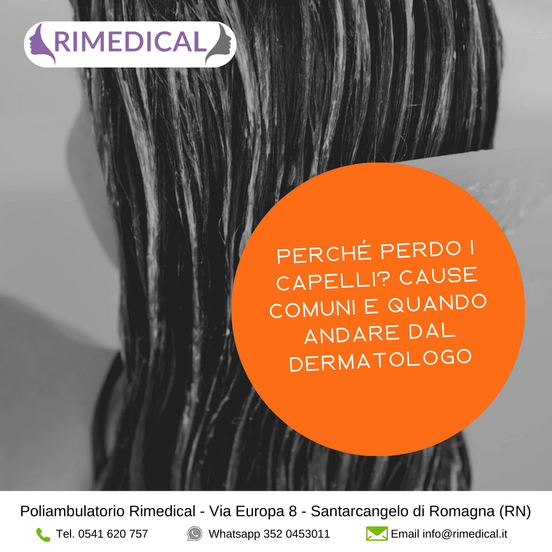 perdita-capelli