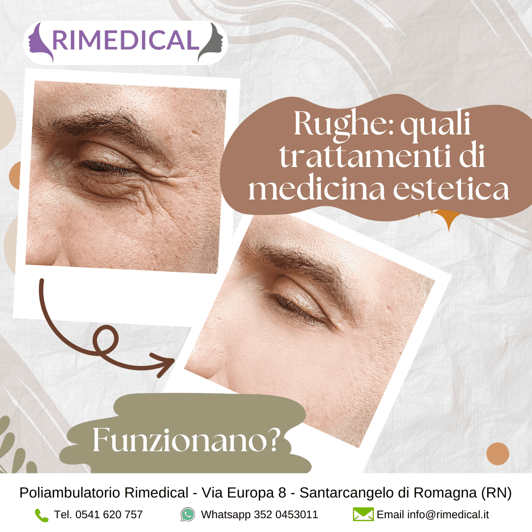 rughe