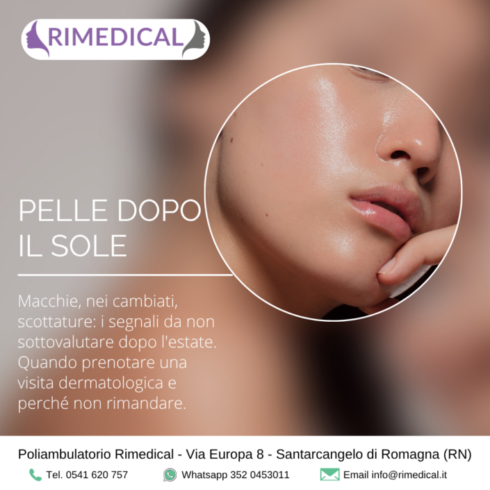 pelle-dopo-sole