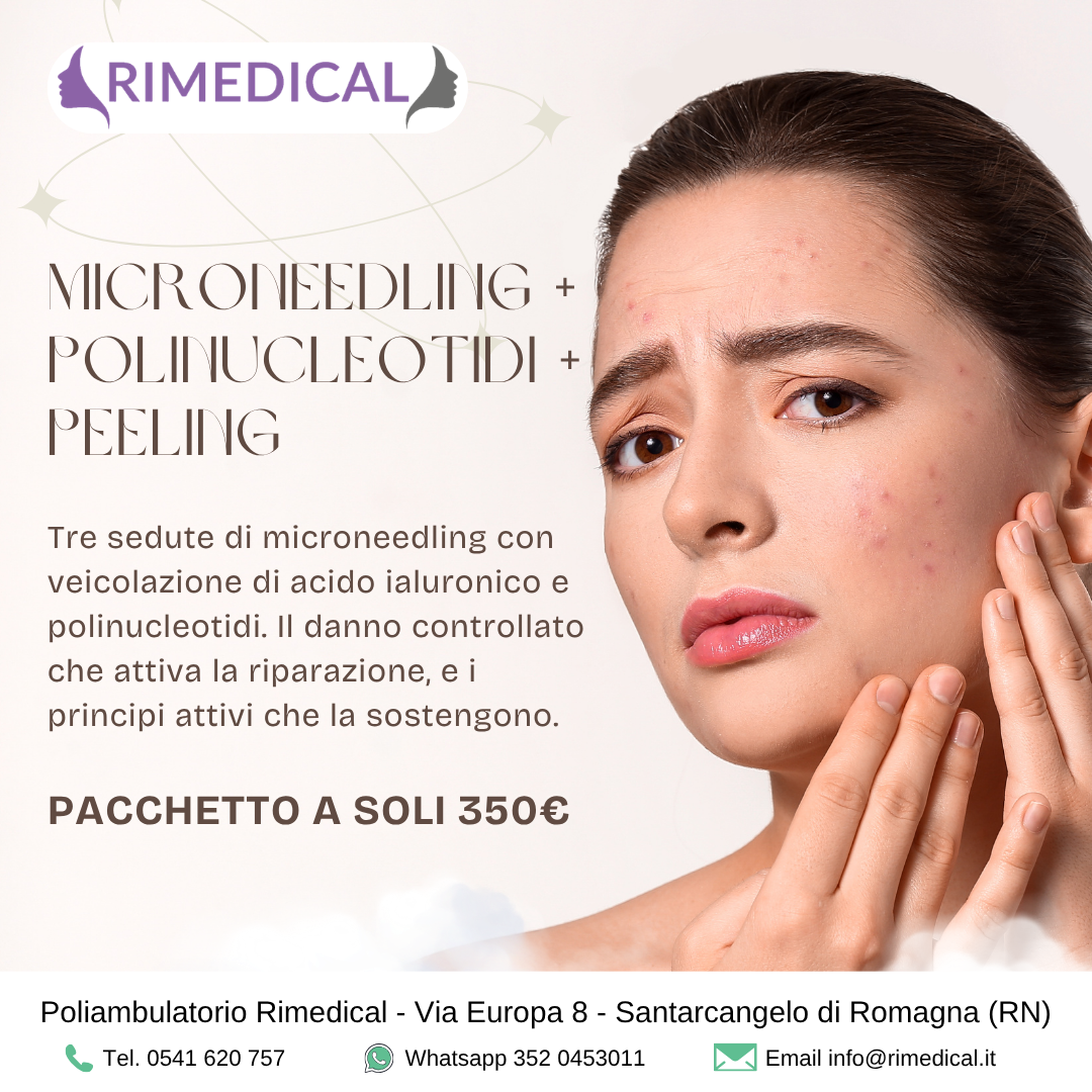 promo-polinucleotidi-peeling-microneedling Microneedling a Rimini: Cicatrici Acne e Fotoinvecchiamento